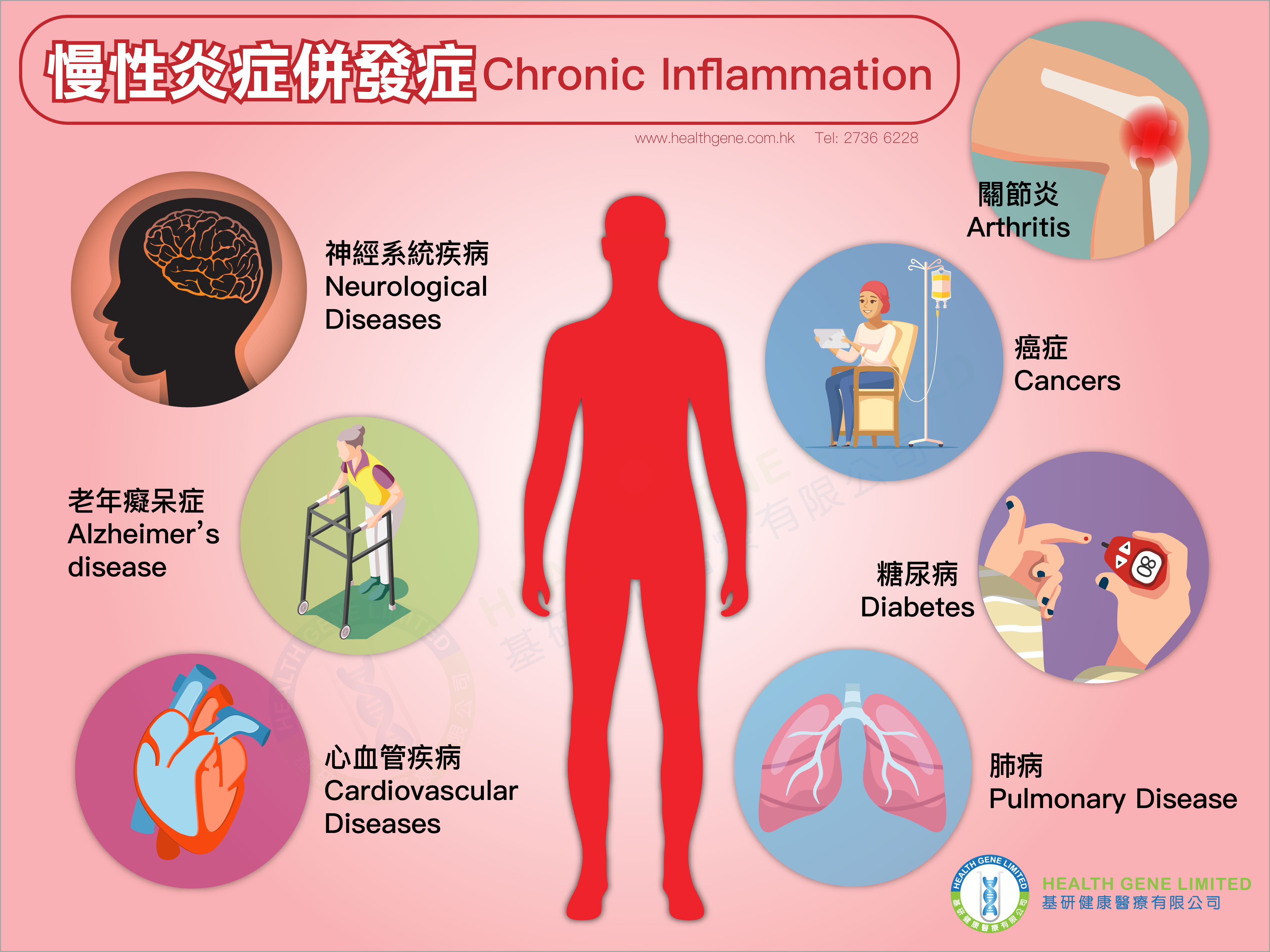 什么是炎症？ | 亘禾健康