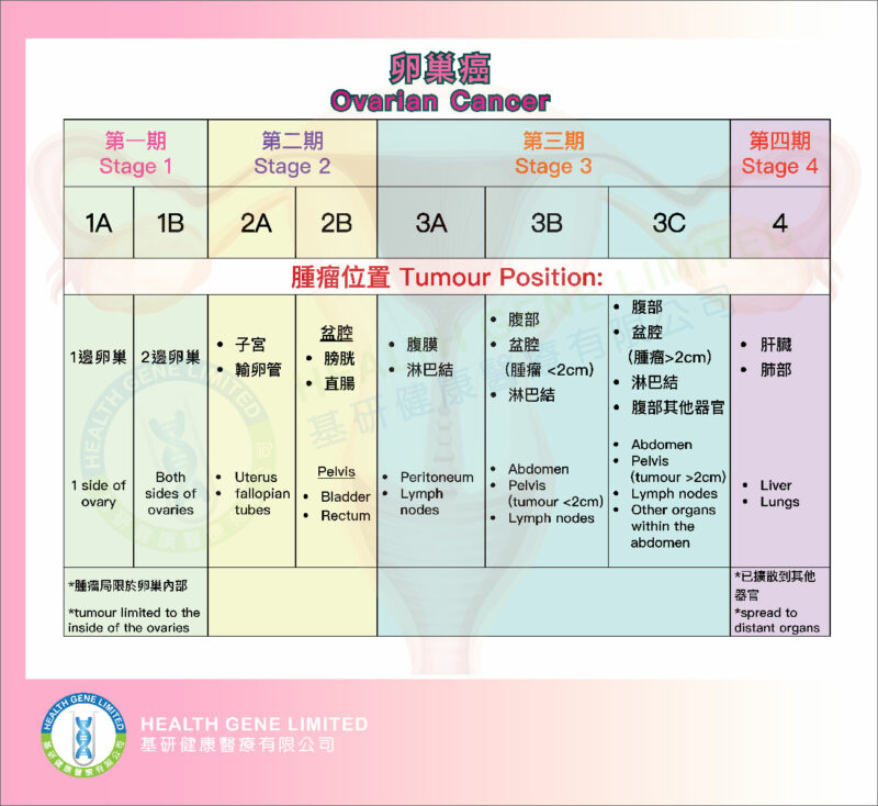 Ovarian Cancer stage table 4