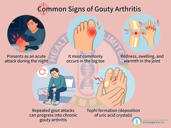 Gouty Arthritis Signs