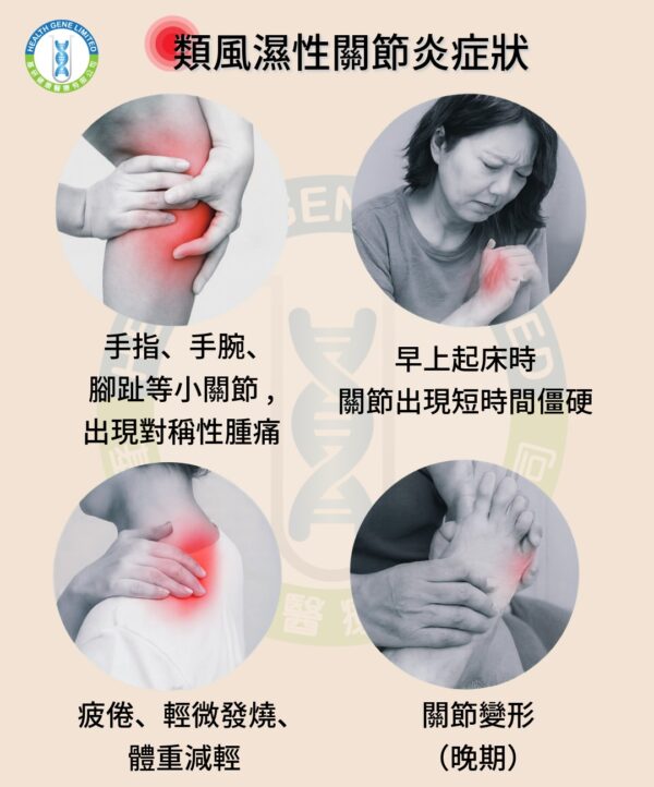 類風濕性關節炎症狀