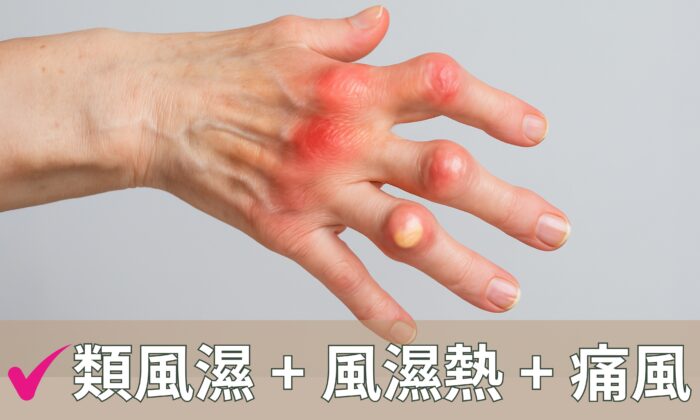 風濕性關節炎檢查