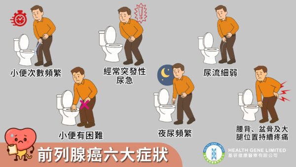 前列腺檢查6大症狀